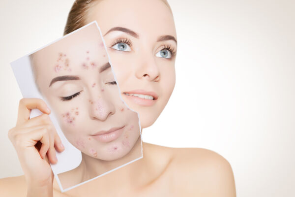 Mikrodermabrasion-Schulung